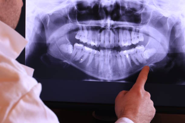 Best Broken or Chipped Tooth Repair in Columbia, MD